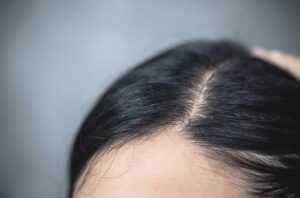 Descubre los mejores tratamientos para el pelo fino y débil